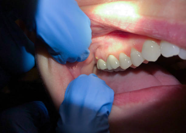 Best Emergency Gum Pain Relief  in Fairfax, IA